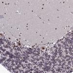 EXOSC3 Antibody in Immunohistochemistry (Paraffin) (IHC (P))