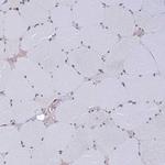 EXOSC3 Antibody in Immunohistochemistry (Paraffin) (IHC (P))