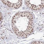 EXOSC3 Antibody in Immunohistochemistry (Paraffin) (IHC (P))