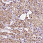 EPHX1 Antibody in Immunohistochemistry (Paraffin) (IHC (P))