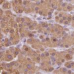 EPHX1 Antibody in Immunohistochemistry (Paraffin) (IHC (P))