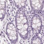 EPHX1 Antibody in Immunohistochemistry (Paraffin) (IHC (P))