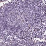 EPHX1 Antibody in Immunohistochemistry (Paraffin) (IHC (P))