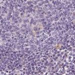 EPHX1 Antibody in Immunohistochemistry (Paraffin) (IHC (P))