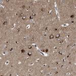 GUCY1B3 Antibody in Immunohistochemistry (Paraffin) (IHC (P))