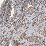 GUCY1B3 Antibody in Immunohistochemistry (Paraffin) (IHC (P))