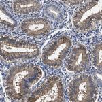 SOCS5 Antibody in Immunohistochemistry (Paraffin) (IHC (P))