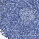 ASS1 Antibody in Immunohistochemistry (Paraffin) (IHC (P))