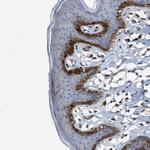 ASS1 Antibody in Immunohistochemistry (Paraffin) (IHC (P))