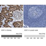 ASS1 Antibody