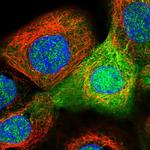 ASS1 Antibody in Immunocytochemistry (ICC/IF)