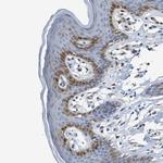 ASS1 Antibody in Immunohistochemistry (Paraffin) (IHC (P))