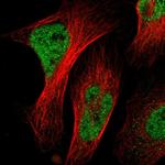 NAC1 Antibody in Immunocytochemistry (ICC/IF)