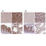 NAC1 Antibody in Immunohistochemistry (Paraffin) (IHC (P))