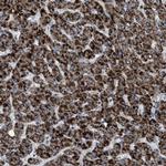 HSD17B4 Antibody in Immunohistochemistry (Paraffin) (IHC (P))