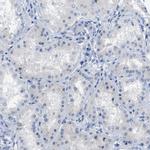 Carboxypeptidase A2 Antibody in Immunohistochemistry (Paraffin) (IHC (P))