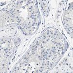 Carboxypeptidase A2 Antibody in Immunohistochemistry (Paraffin) (IHC (P))