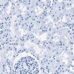 CPS1 Antibody in Immunohistochemistry (Paraffin) (IHC (P))