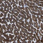 CPS1 Antibody in Immunohistochemistry (Paraffin) (IHC (P))