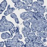 CPS1 Antibody in Immunohistochemistry (Paraffin) (IHC (P))