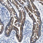 CPS1 Antibody in Immunohistochemistry (Paraffin) (IHC (P))