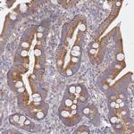 NPEPPS Antibody in Immunohistochemistry (Paraffin) (IHC (P))