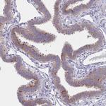 NPEPPS Antibody in Immunohistochemistry (Paraffin) (IHC (P))