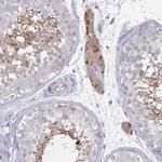 NPEPPS Antibody in Immunohistochemistry (Paraffin) (IHC (P))