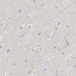 PRKD2 Antibody in Immunohistochemistry (Paraffin) (IHC (P))