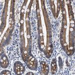 Jagged1 Antibody in Immunohistochemistry (Paraffin) (IHC (P))