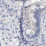 CTH Antibody in Immunohistochemistry (Paraffin) (IHC (P))