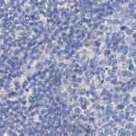 CTH Antibody in Immunohistochemistry (Paraffin) (IHC (P))