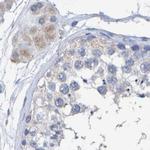 CTH Antibody in Immunohistochemistry (Paraffin) (IHC (P))