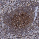 Ezrin Antibody in Immunohistochemistry (Paraffin) (IHC (P))