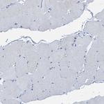 Ezrin Antibody in Immunohistochemistry (Paraffin) (IHC (P))