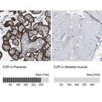 Ezrin Antibody