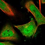 MBTD1 Antibody in Immunocytochemistry (ICC/IF)