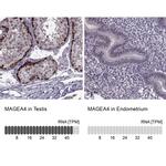 MAGEA4 Antibody