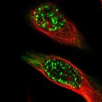 MAGEA4 Antibody in Immunocytochemistry (ICC/IF)