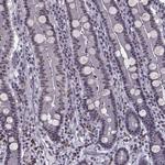 MAGEA4 Antibody in Immunohistochemistry (Paraffin) (IHC (P))