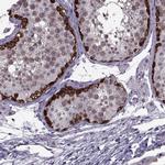 MAGEA4 Antibody in Immunohistochemistry (Paraffin) (IHC (P))