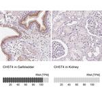 CHST4 Antibody