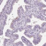 CHST4 Antibody in Immunohistochemistry (Paraffin) (IHC (P))