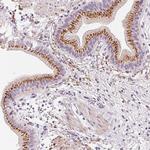 CHST4 Antibody in Immunohistochemistry (Paraffin) (IHC (P))