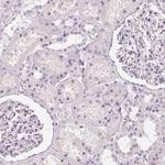 CHST4 Antibody in Immunohistochemistry (Paraffin) (IHC (P))