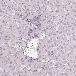 CHST4 Antibody in Immunohistochemistry (Paraffin) (IHC (P))