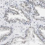 ATF2 Antibody in Immunohistochemistry (Paraffin) (IHC (P))