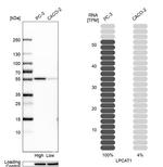 LPCAT1 Antibody