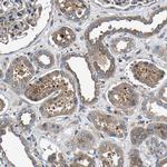 LPCAT1 Antibody in Immunohistochemistry (Paraffin) (IHC (P))