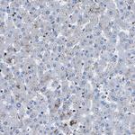 LPCAT1 Antibody in Immunohistochemistry (Paraffin) (IHC (P))